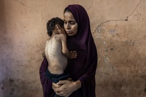 Pulitzer_Saher-Alghorra_Gaza_07_0